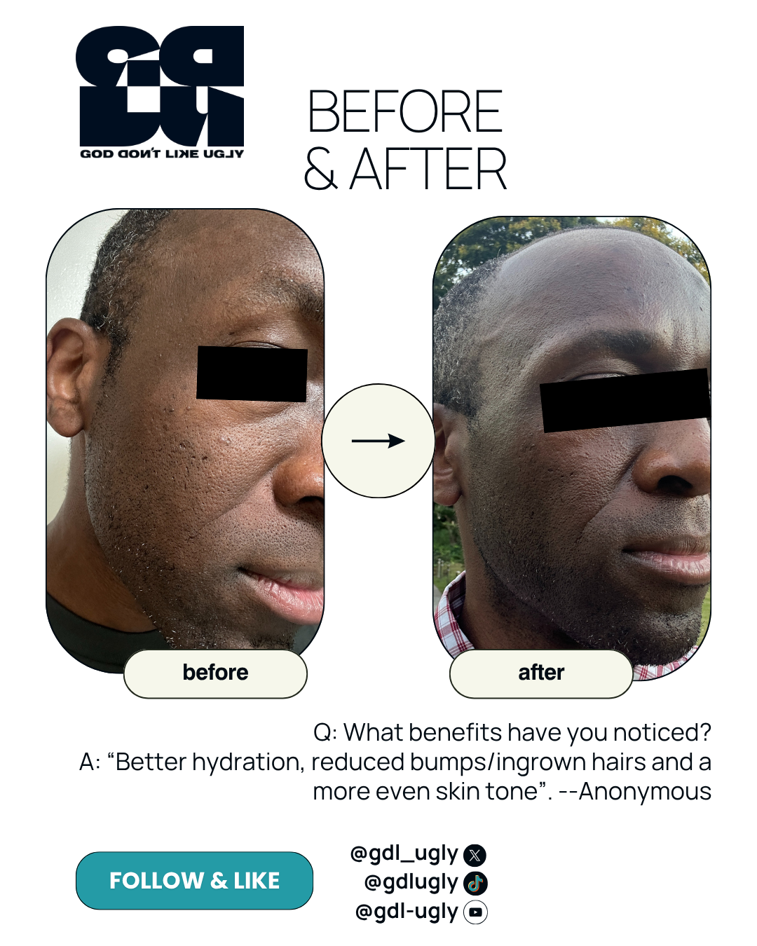 After 4-weeks of consistent use, how would you describe the overall impact of the GDLU Gel Cream?