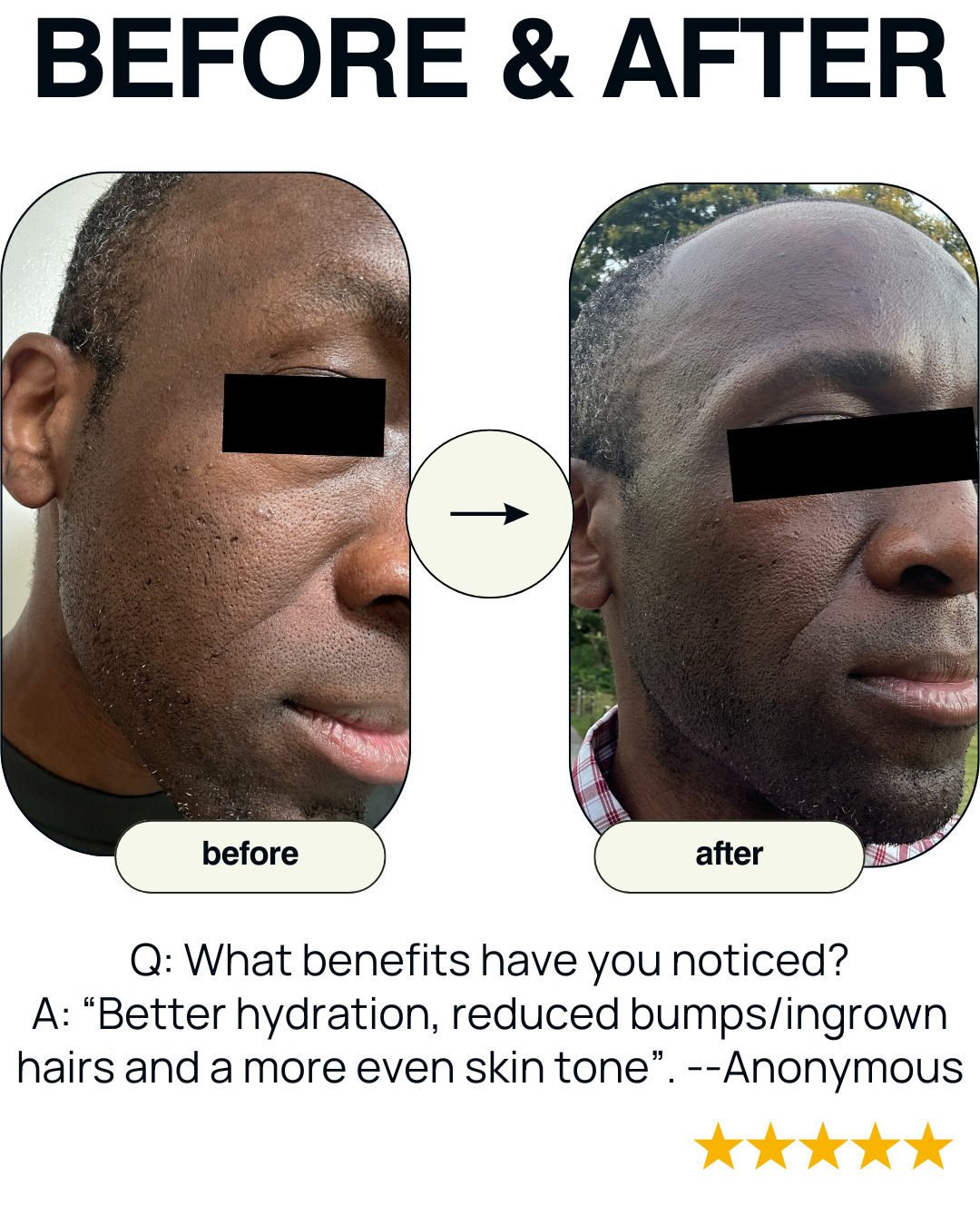 After 4-weeks of consistent use, how would you describe the overall impact of the GDLU Gel Cream?